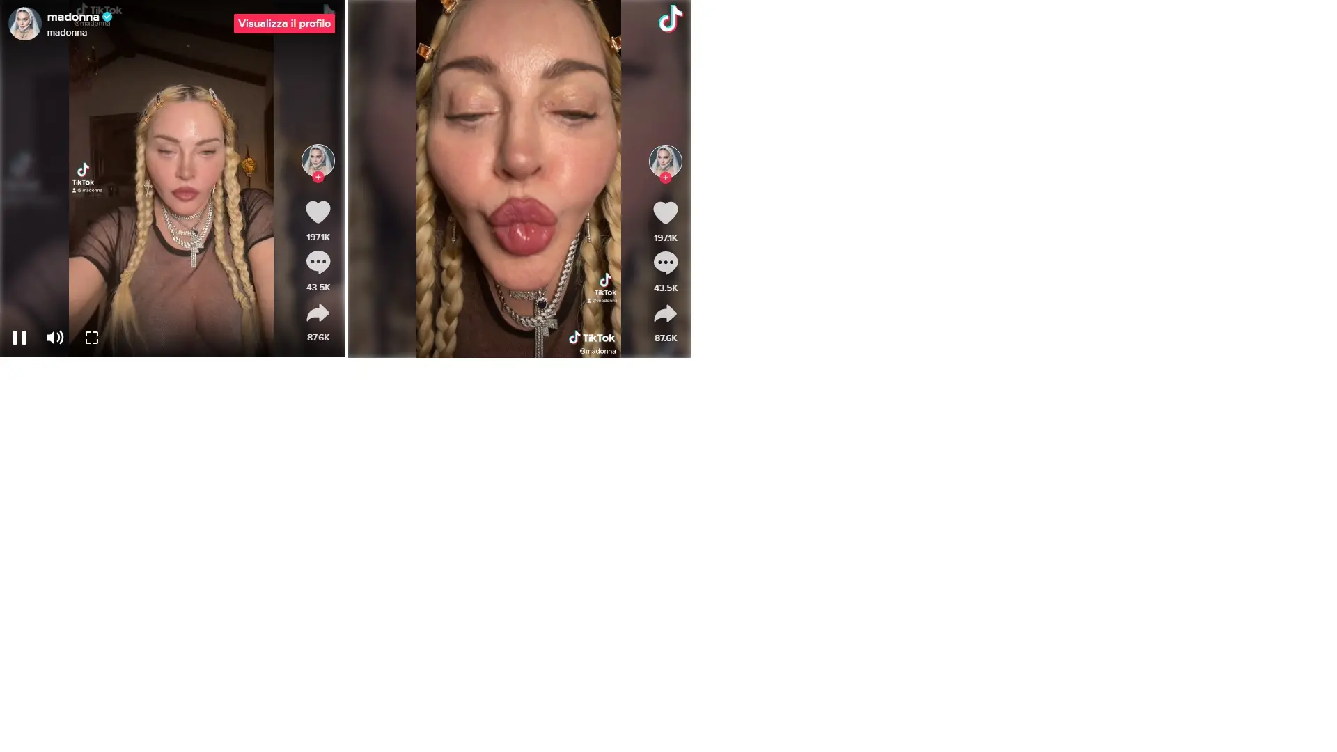 Madonna irriconoscibile su TikTok, viso e labbra gonfie: il video fa preoccupare i fan