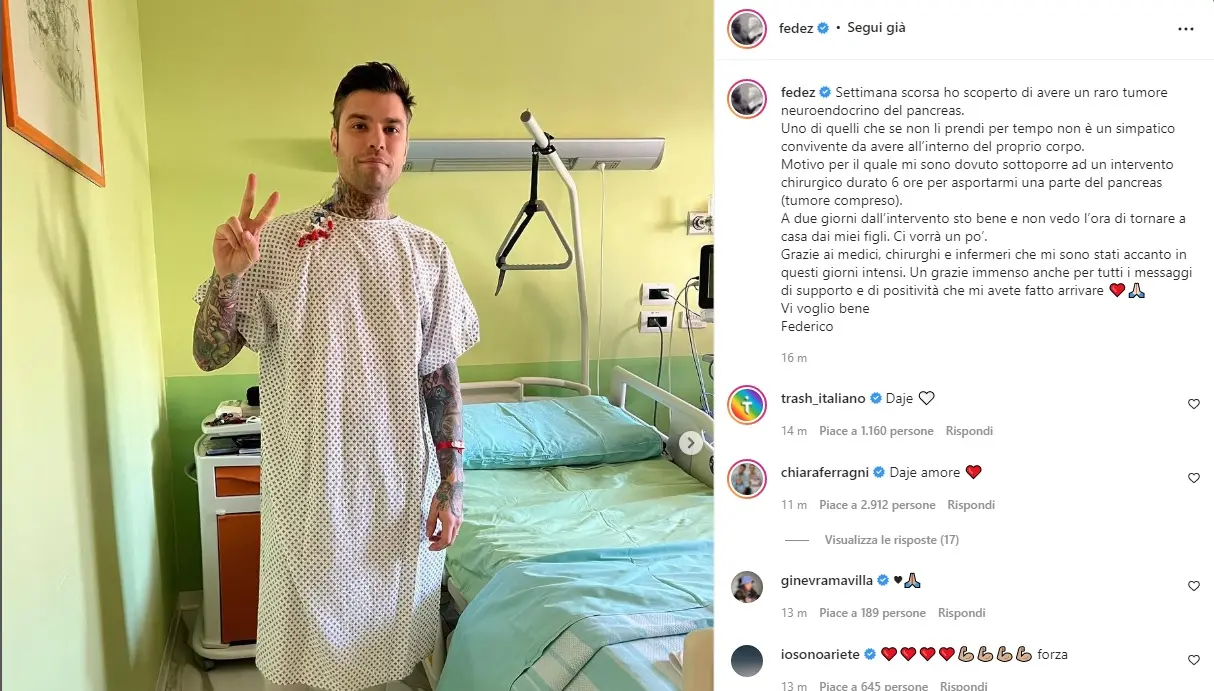 Fedez, tumore neuroendocrino al pancreas: cos'è e come si cura