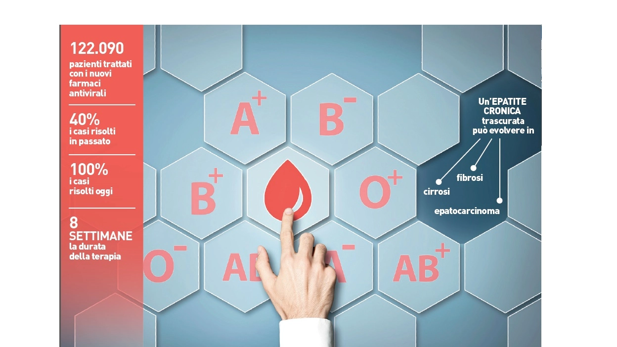 Infografica HCV, i numeri dell'epatite C