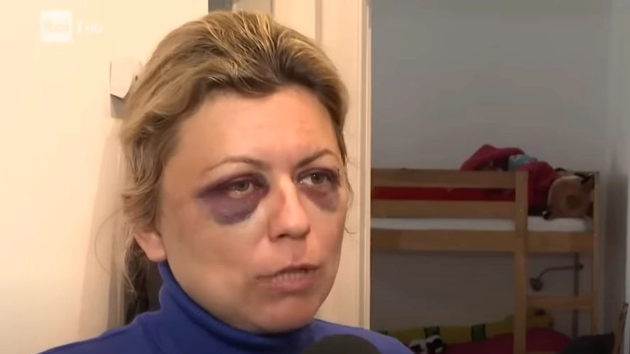 La signora vittima della brutale aggressione, che ha preferito non rivelare il suo nome