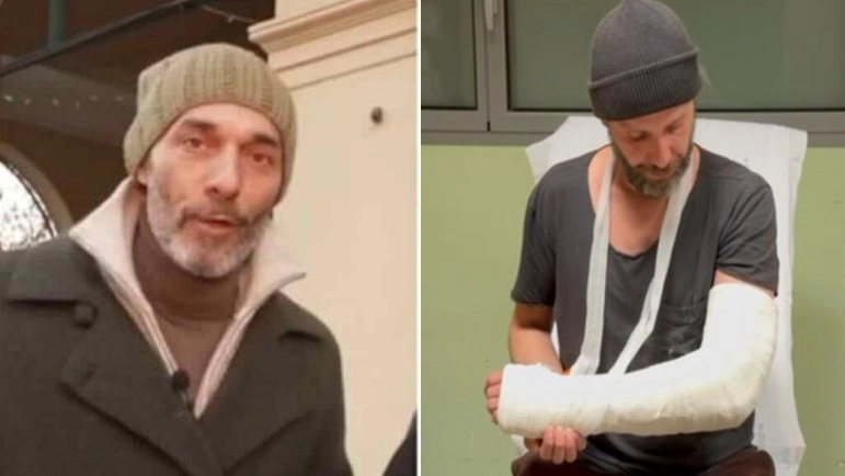 Max Laudadio, inviato di Strsicia la Notizia (frame video) e il cameraman con il gesso al braccio dopo un'aggressione durante un servizio