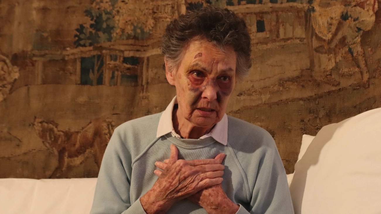Mariela, l'anziana aggredita da un clochard in via Carducci a Milano (Foto Paolo Salmoirago)