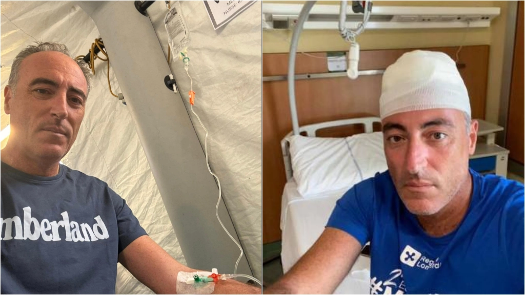 Giulio Gallera all'ospedale da campo della maratona (a sinistra) e quattro anni fa dopo l'infortunio durante il padel (a destra)