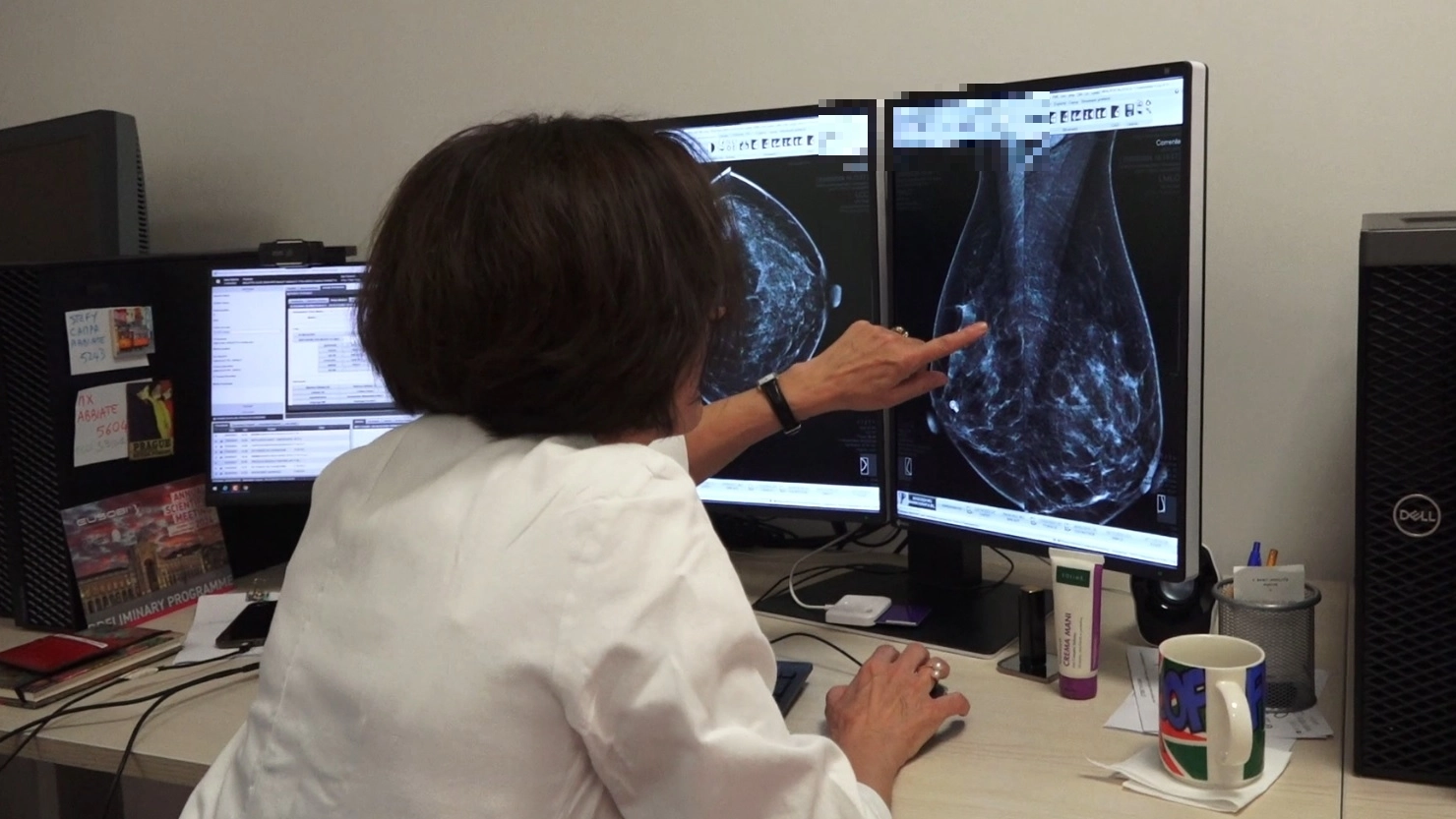 Nuovo mammografo all'ospedale Fornaroli