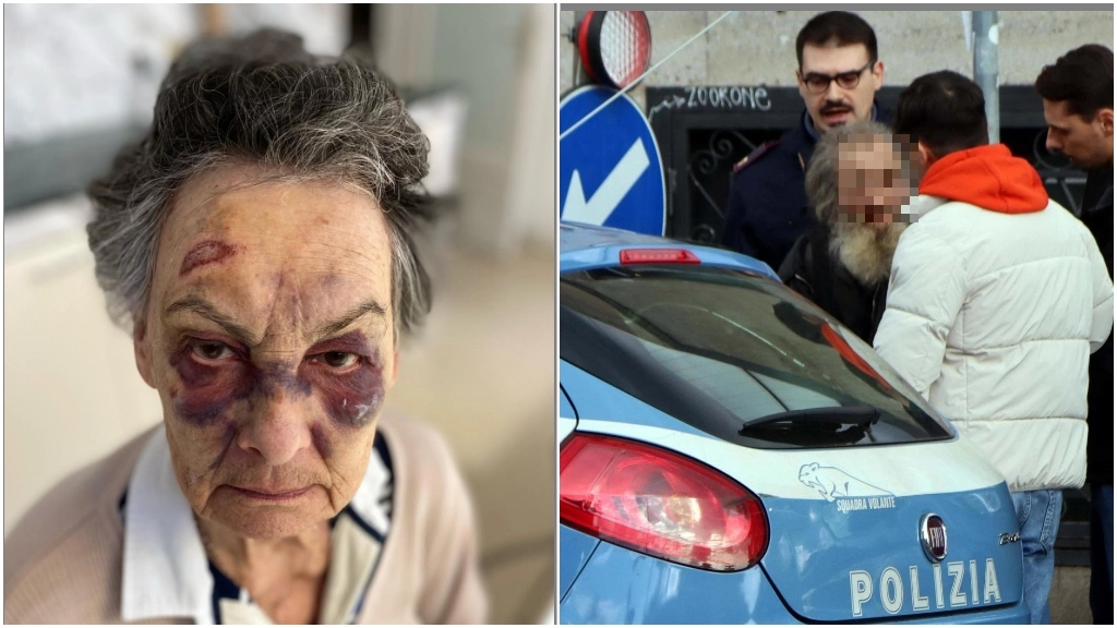 Le ferite sul volto dell'anziana dopo l'aggressione. A destra, l'uomo accusato di aver colpito la donna fermato dalla polizia (Foto Salmoirago)